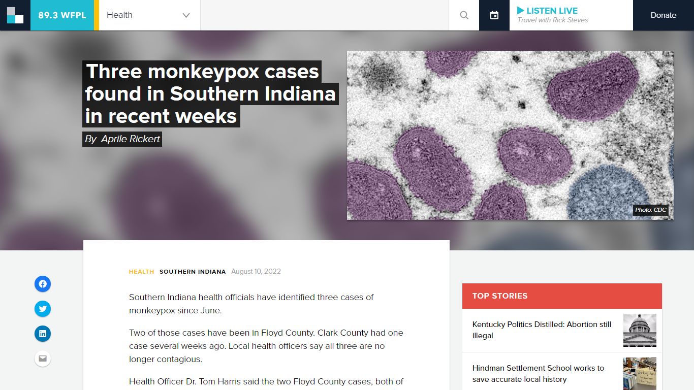 Three monkeypox cases found in Southern Indiana in recent weeks